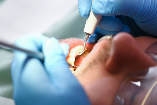 Best Same-Day Emergency Dental Services in Garnett, KS
