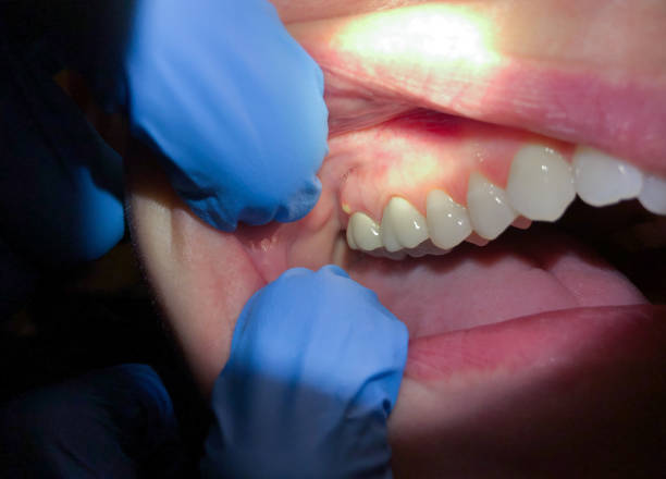 Best Emergency Gum Treatment in Garnett, KS