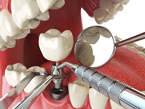 Best Emergency Denture Repair in Garnett, KS