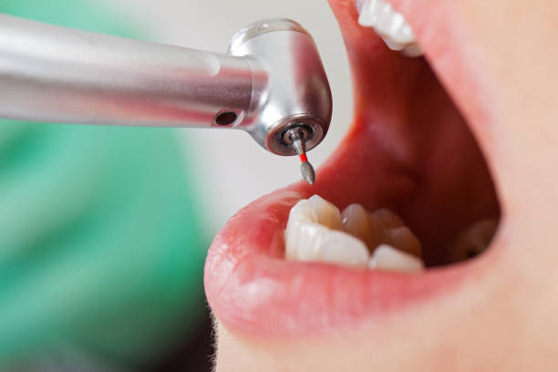 Best Pediatric Emergency Dentist in Garnett, KS
